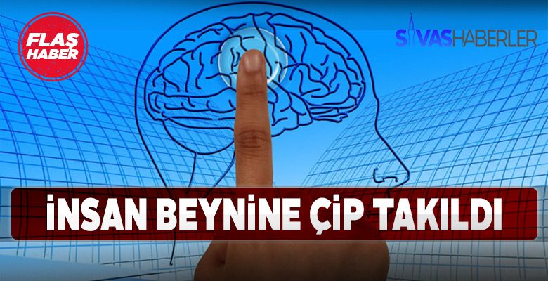 İnsan beynine çip takıldı
