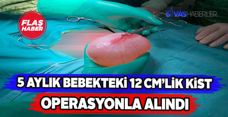 Sivas’ta 5 aylık bebeğe mucizevi operasyon