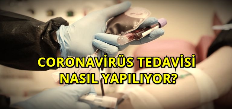 Coronavirüs Tedavisi Nasıl Yapılıyor?