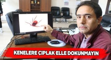 Vücutta kene görülünce panik yapılmamalı