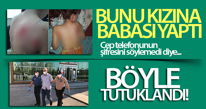Kızını İngiliz anahtarıyla dövdüğü iddia edilen baba tutuklandı