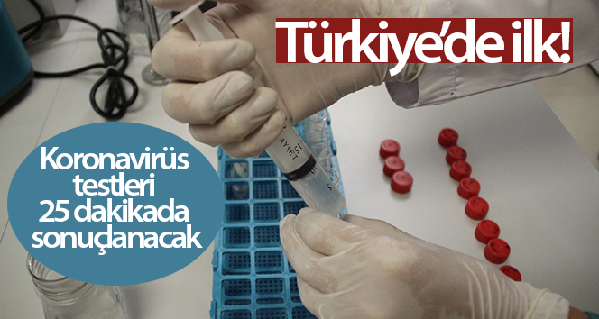 Türkiye’de bir ilk! Koronavirüs testleri 25 dakika içinde sonuçlanacak