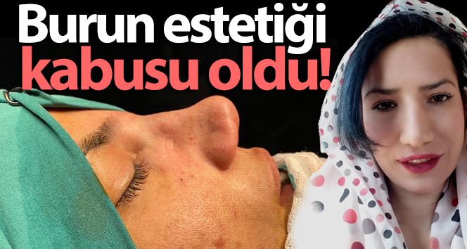 Rinoplasti kabusa dönüştü