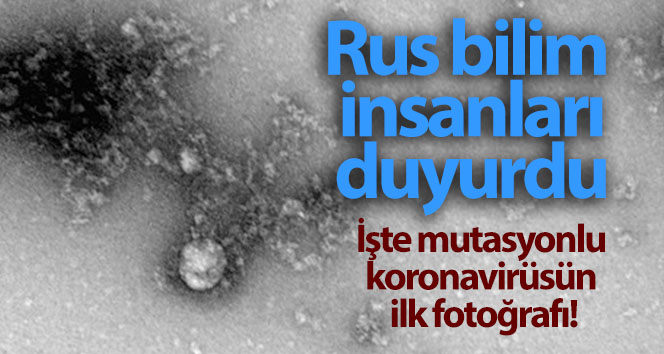 Rusya’da, korona virüs mutasyonunun fotoğrafı çekildi