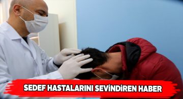 Üniversite hastanesinden sedef hastalığı için yeni poliklinik
