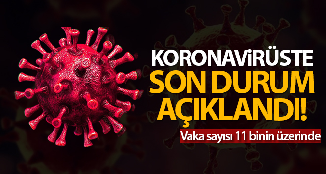 Türkiye’de son 24 saatte 11.322 koronavirüs vakası tespit edildi