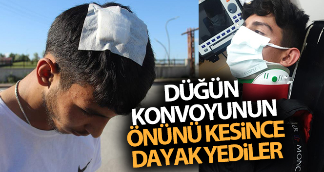 Düğün konvoyunun önünü kesince hastanelik oldular