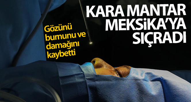 Kara mantar hastalığı Meksika’ya da sıçradı