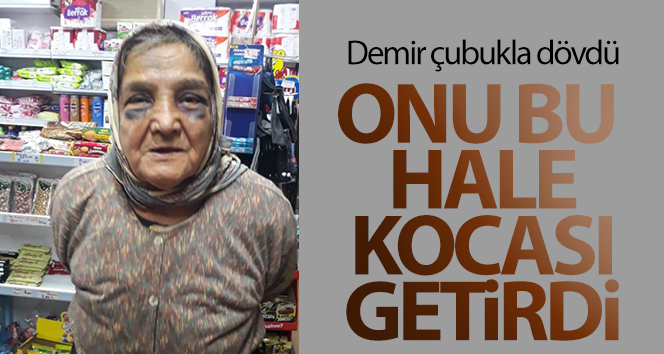 Demir çubukla dövdüğü 73 yaşındaki eşini, bakın ne hale soktu