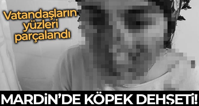 Mardin’de sokak köpeği vahşeti: Vatandaşların yüzleri parçalandı
