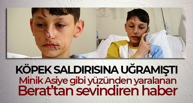 Minik Asiye gibi yüzünden yaralanan Berat’tan sevindiren haber