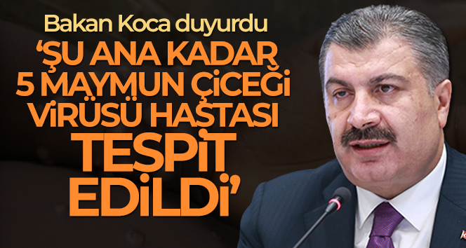 Bakan Koca: ‘Şu ana kadar ülkemizde 5 maymun çiçeği virüsü hastası tespit edildi’