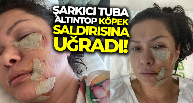 Ünlü şarkıcı Tuğba Altıntop köpek saldırısına uğradı