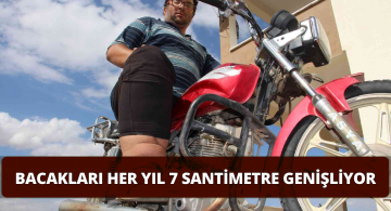 Bacakları her Geçen Gün Genişliyor