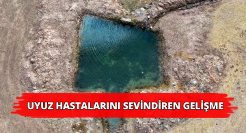 Uyuz Hastalarına Sevindirici Haber