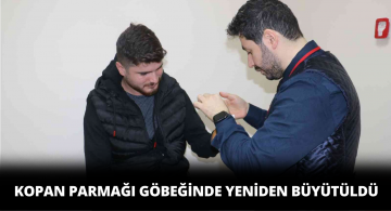 Kopan Parmak Göbekte Yeniden Büyütüldü