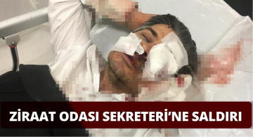 Ziraat Odası Genel Sekreteri Bekir Yıldız’a Saldırı