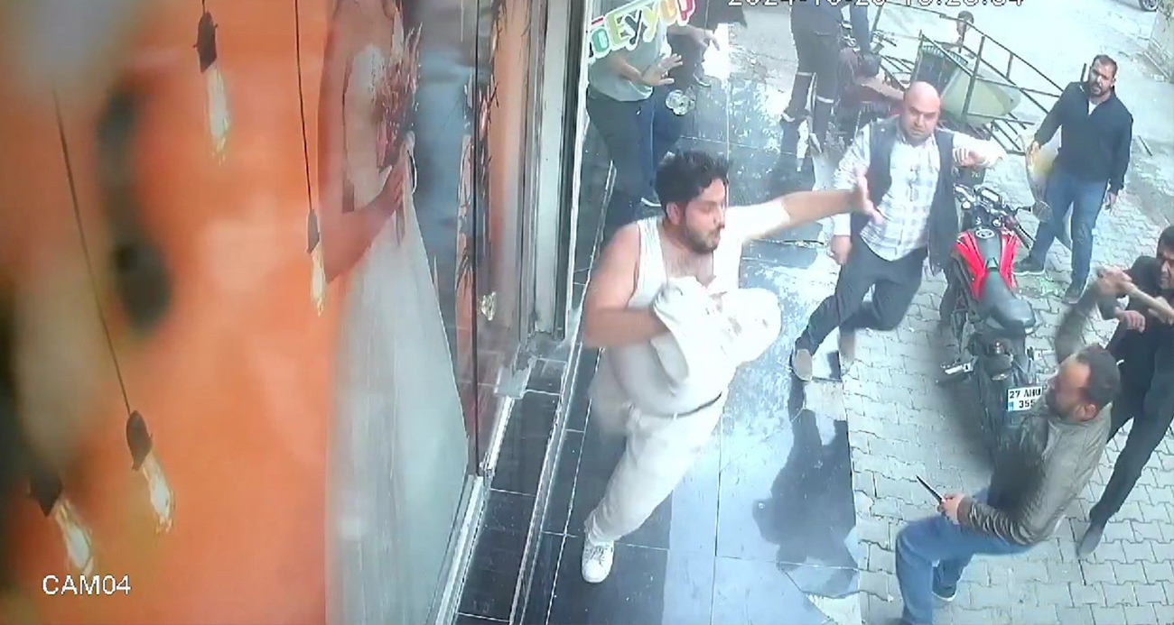 Şanlıurfa’da Fotoğrafçı Kardeşlere Saldırı: Muhtar ve Yakınları Tarafından Darp