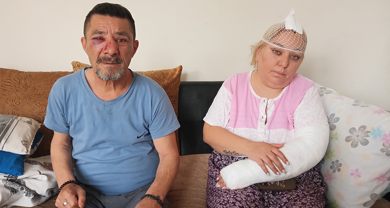 Ankara’da Kiracı Ailesine Şiddet Uygulayan Ev Sahibi Gözaltına Alındı