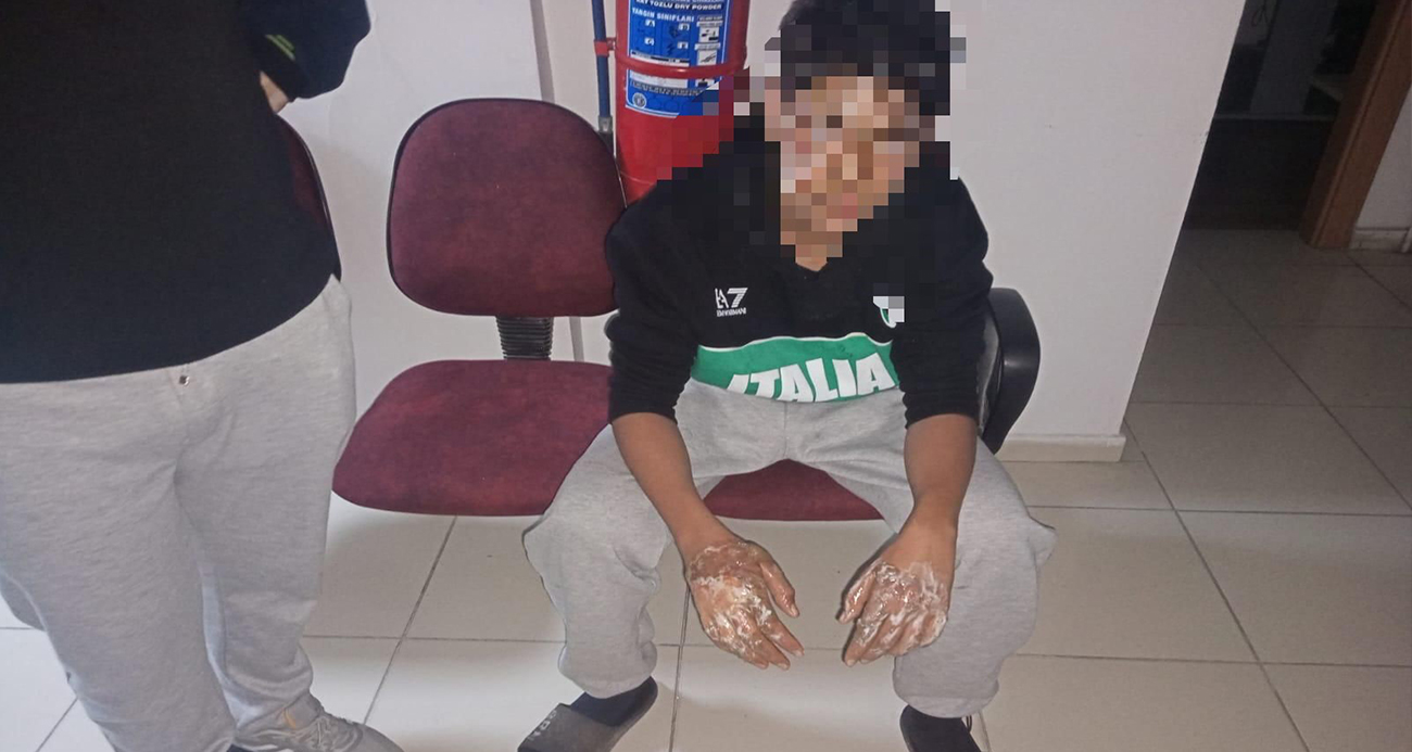 Kayseri’de Genç Çocuğun Fırın Kazası