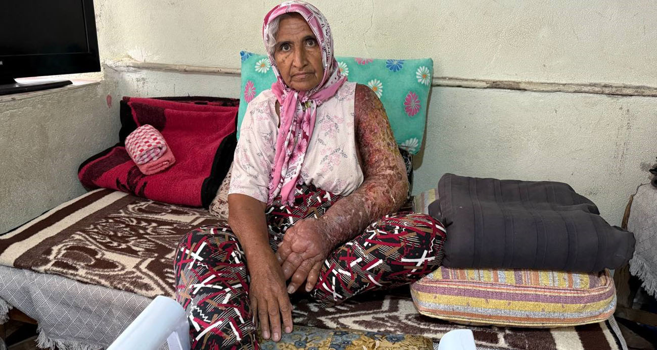 Adana’da Sağlık Mücadelesi: 4 Çocuk Annesi Yardım Bekliyor