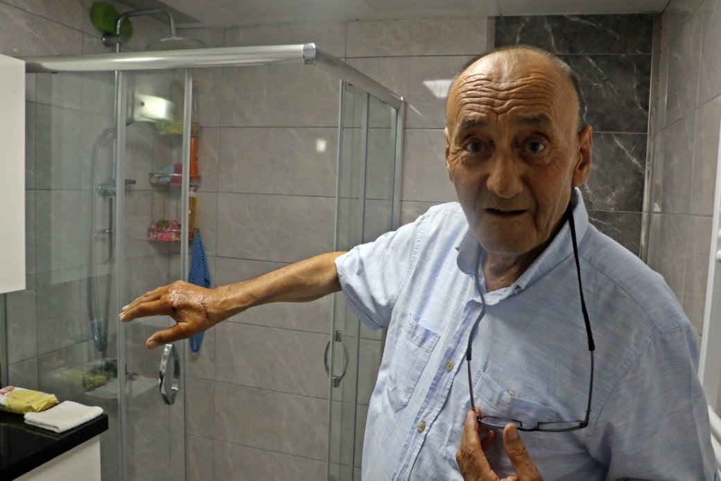 Emekli Akademisyenin Banyo Kabusu: Duş Kabininin Patlamasıyla Yaralandı