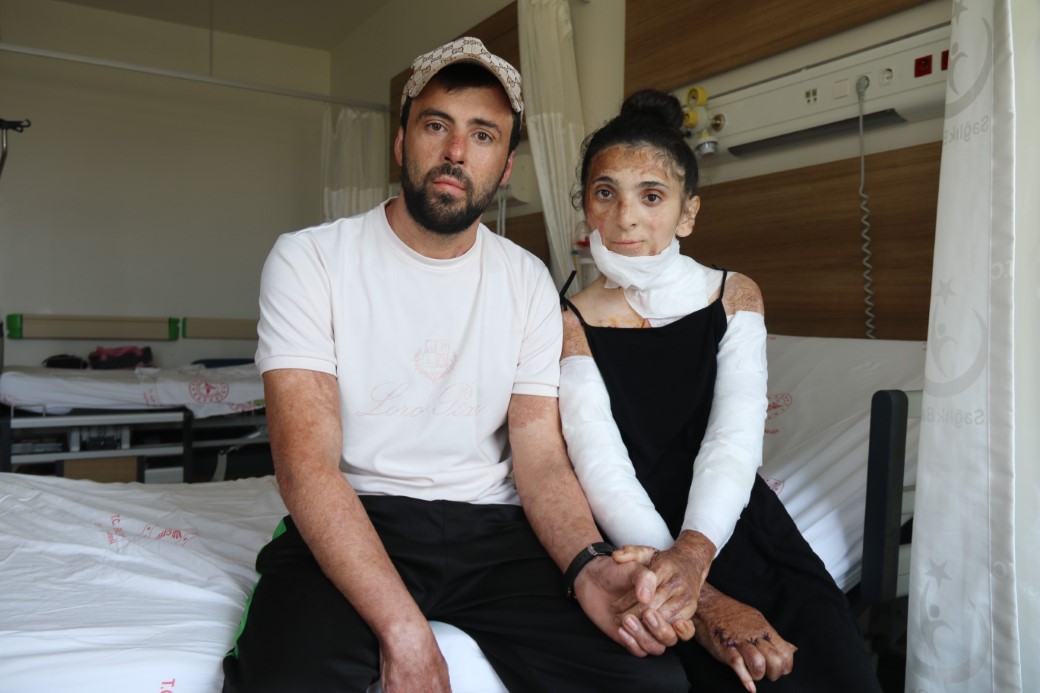 Azerbaycanlı Çift, Eskişehir’de Gerçekleşen Başarılı Ameliyatla Ellerini Yeniden Kullanabiliyor