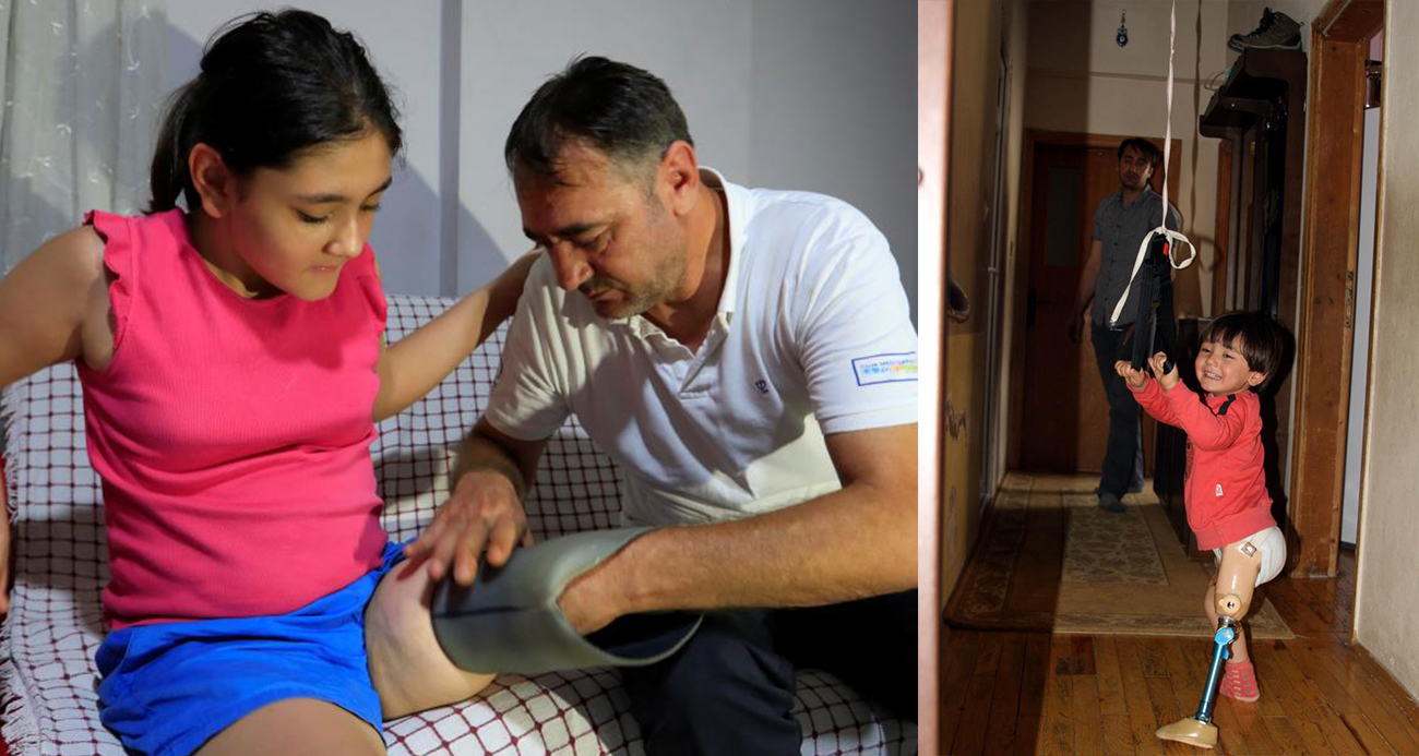 12 Yaşındaki Özge İçin Türkiye Seferber Oldu: Yeni Protez Parası Kısa Sürede Toplandı