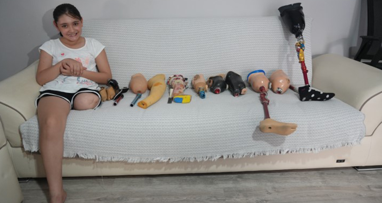 Okula Dönüş Yaklaşırken Protez Engeli: 12 Yaşındaki Özge’nin Hikayesi