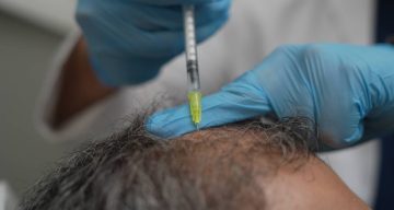 Dökülen saçlar vücudun bir alarmı olabilir