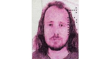 İngiliz Vatandaşı, Türkiye’deki Sağlık İşlemleri Sonrası Yaşamını Yitirdi