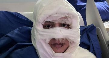 İstanbul Kadıköy’de Dehşete Düşüren Saldırı: Kadın, Başka Bir Kadın Tarafından Yakıldı