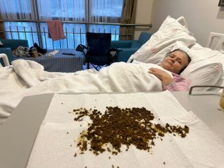 Soma’da Gerçekleşen Olağanüstü Ameliyat: 70 Yaşındaki Hastanın Safra Kesesinden 20 Bin Taş Çıkarıldı