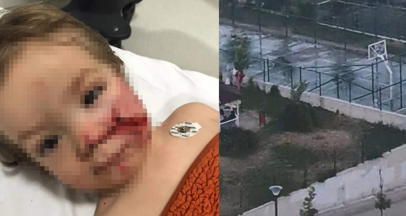 Ankara Etimesgut’ta Pitbull Dehşeti: İki Kardeşe Saldırı