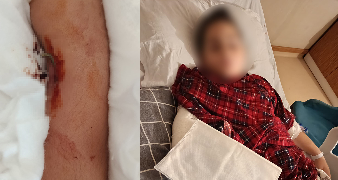 Büyükçekmece’de Akran Zorbalığı: Genç Öğrencinin Kolunu Kıran Şiddet Olayı