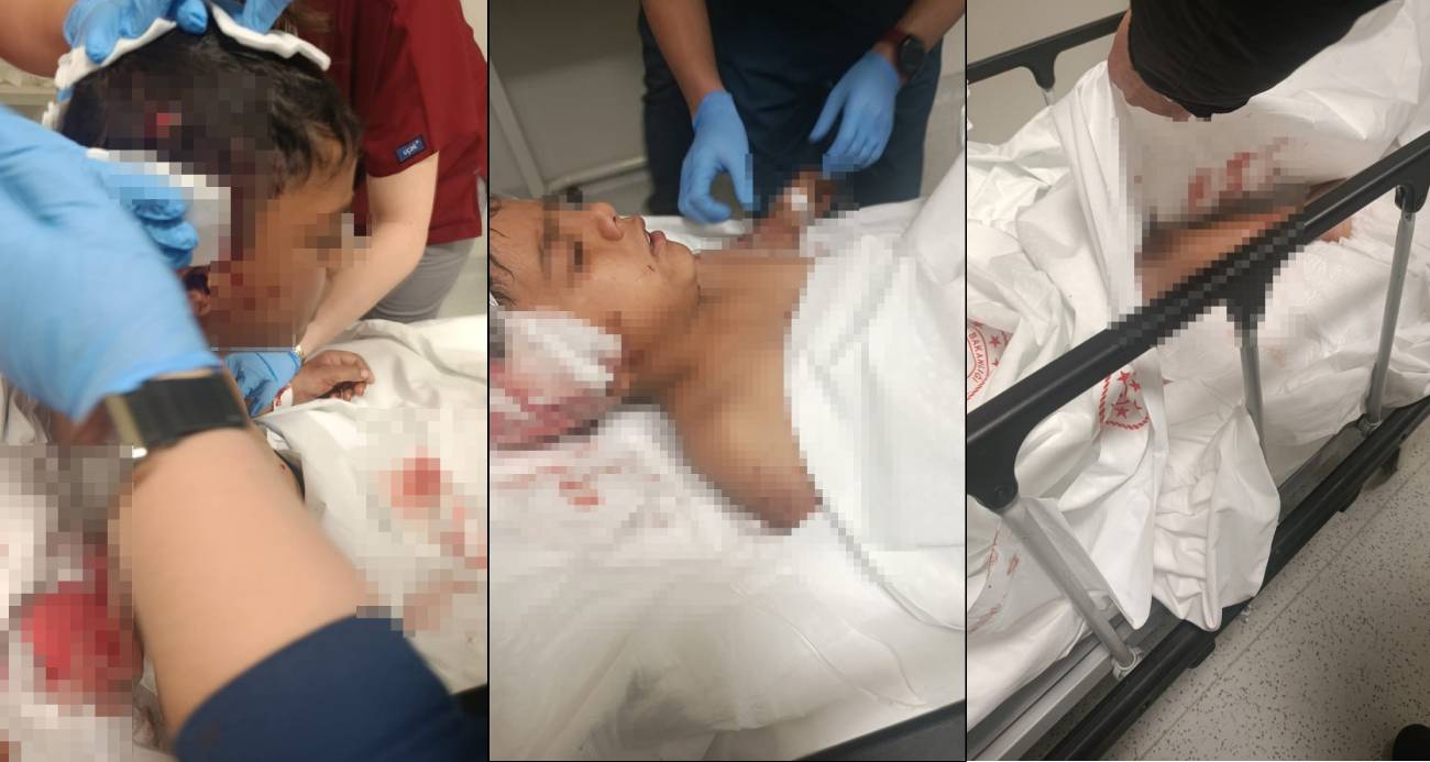 Ankara Altındağ’da Sokak Köpeği Bir Çocuğu Yaraladı