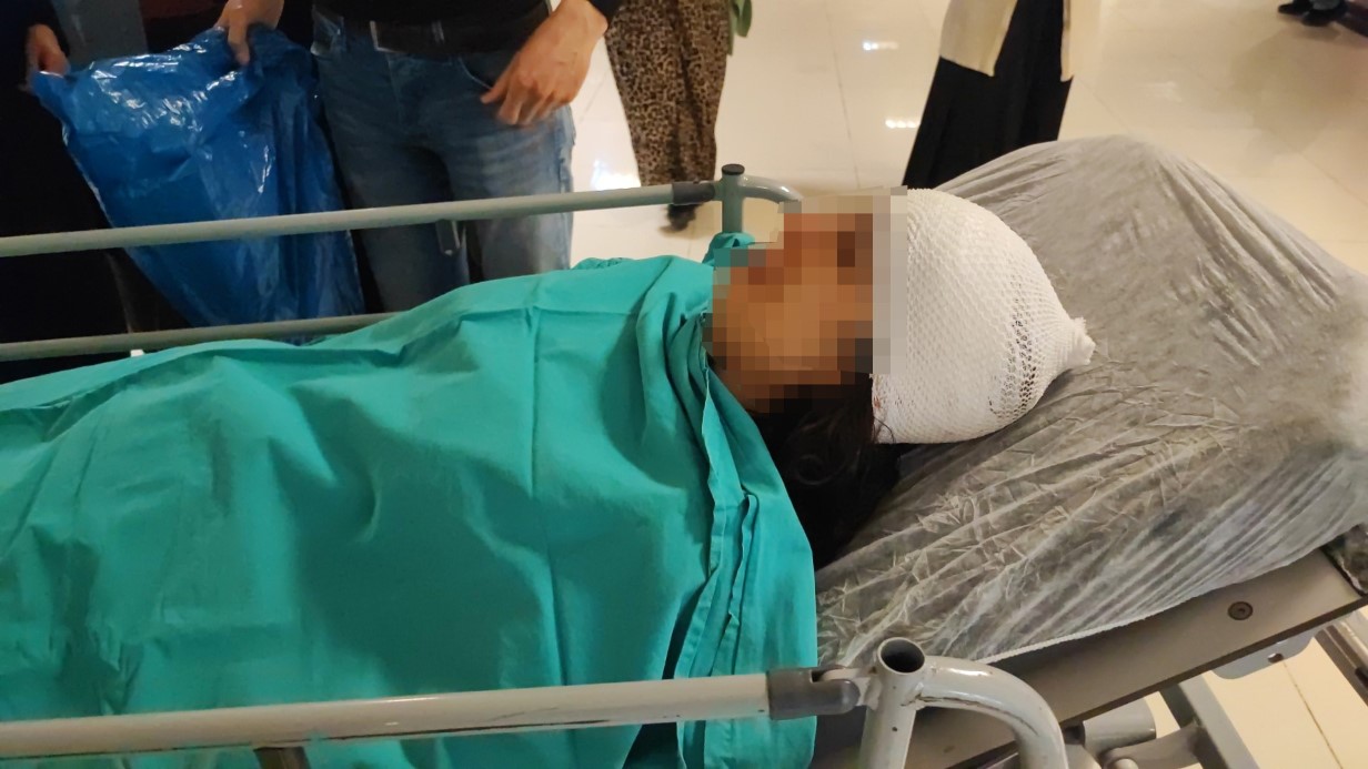 Adana’da Sokak Köpeklerinin Saldırısına Uğrayan Genç Kız Yaralandı