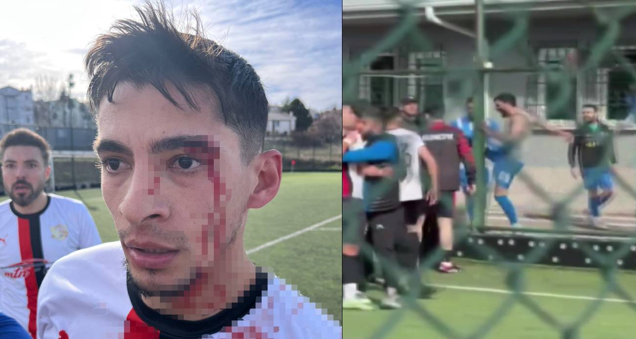 Amatör Futbol Maçı Sonrası Olaylar: 3 Oyuncu Yaralandı