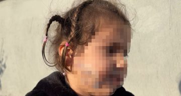 İzmir’de Korkunç Köpek Saldırısı: Küçük Ada Ağır Yaralandı