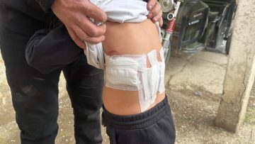 Küçük Çocuğa Eşek Saldırısı: Aile Korku Dolu Anlar Yaşadı