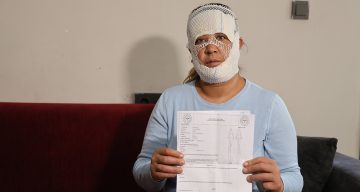 Adana’da Güzellik Merkezi Faciası: Cilt Bakımı Sonrası Yüzünde Yanıklar Oluştu