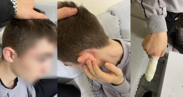 Esenyurt’ta 14 Yaşındaki Çocuğa Yanlış Anlama Sonucu Şiddet Uygulandı