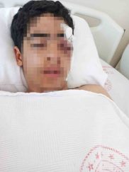 İstanbul’da Akran Zorbalığı: Genç Çocuk Ağır Yaralandı