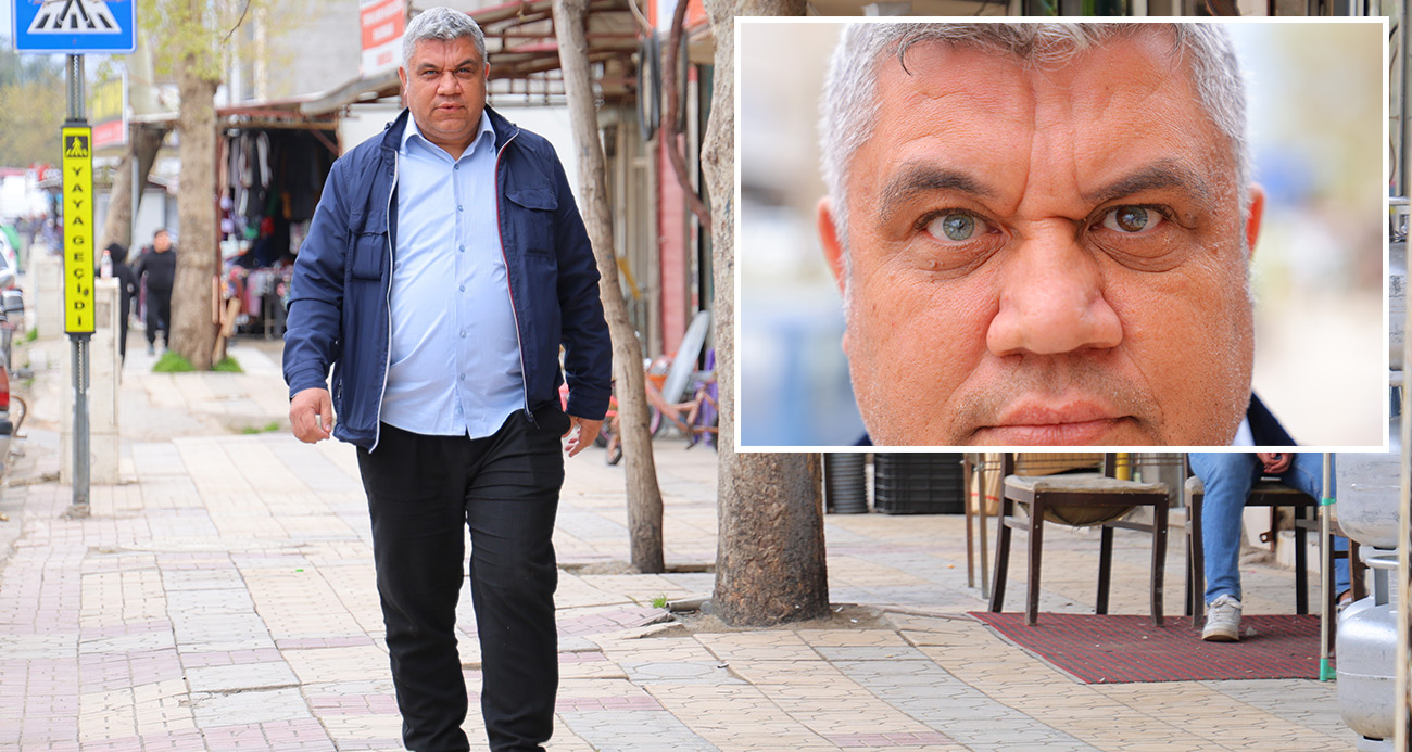 Kahramanmaraş’ta Üç Renkli Gözleriyle Dikkat Çeken Adam