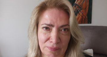Güzellik merkezinde estetik operasyonu yüz felci yaptı