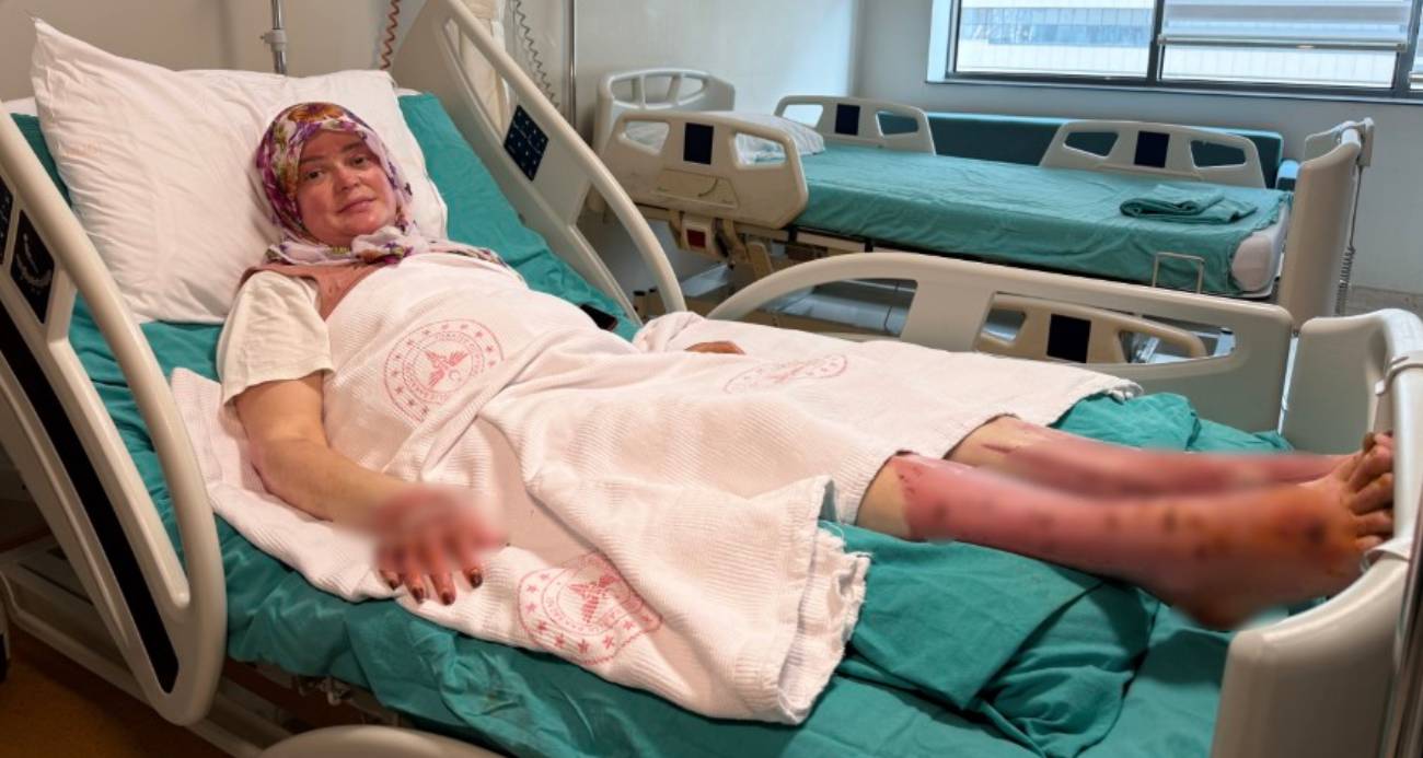 Karavandaki patlama sonrası vücudunun yüzde 70’i yandı: “Karadeniz turu yapacaktık, alev topuna döndüm”
