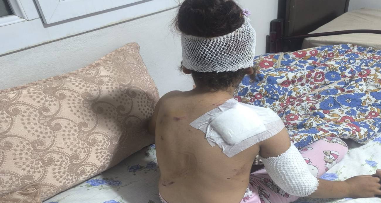 Suruç’ta başıboş köpekler 8 yaşındaki çocuğa saldırdı