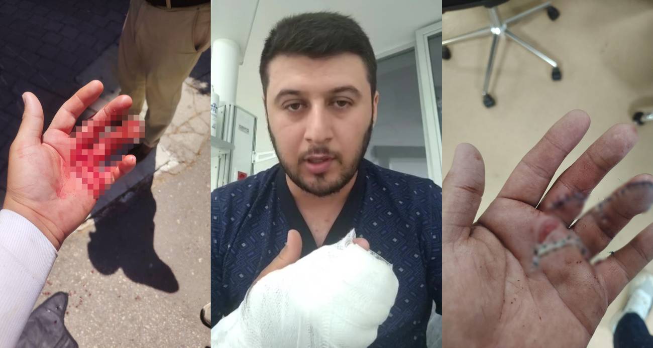 Motokuryeye döner bıçaklı saldırı