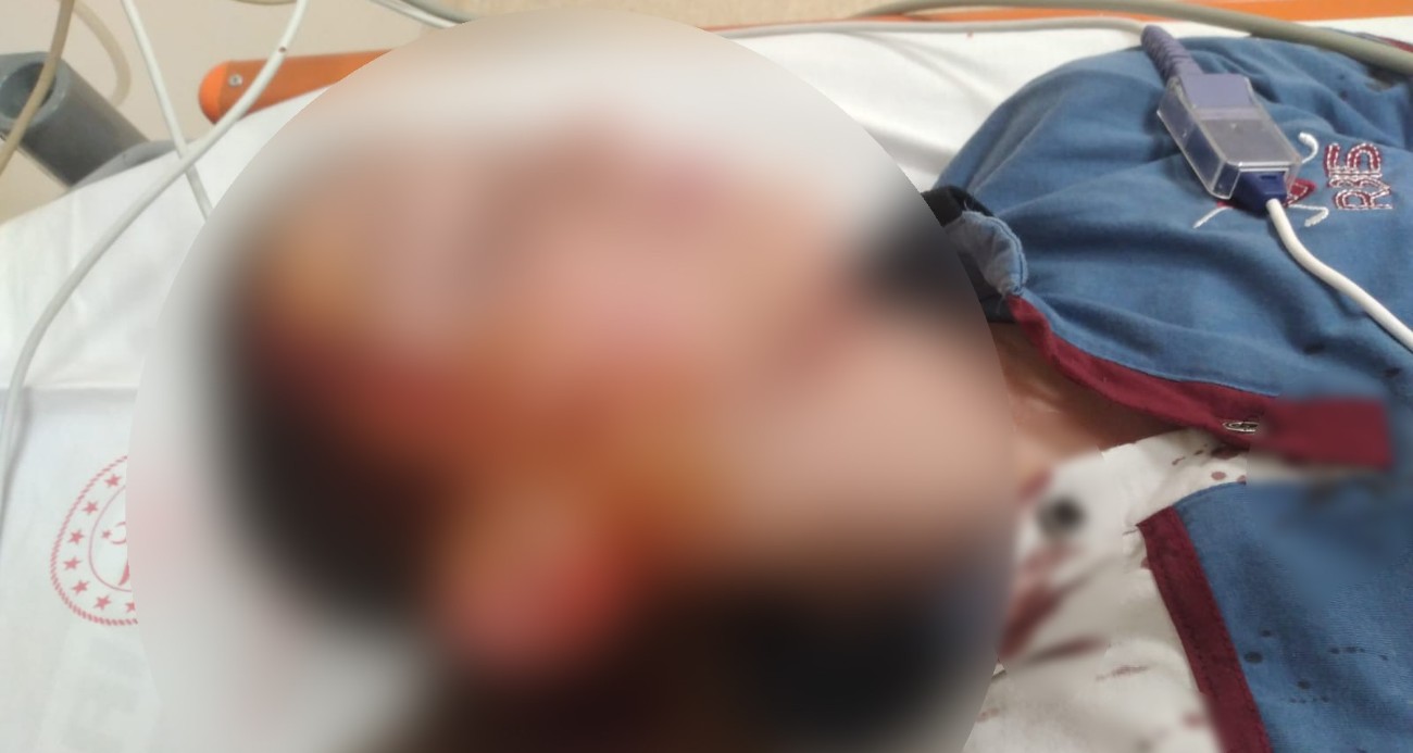 Köpek saldırısında yaralanan çocuk için 1 milyon 200 bin tazminat